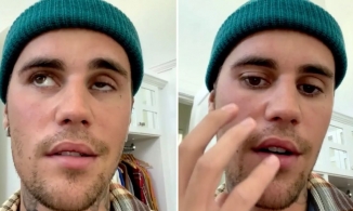 Justin Bieber hủy mọi show diễn vì bị liệt nửa mặt do nhiễm virus hiếm