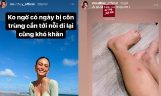 Đi nghỉ dưỡng sang chảnh, Mâu Thủy bị côn trùng cắn nổi “hoa” đầy chân, đi lại cũng khó khăn