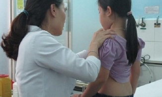 Bé gái 6 tuổi ở Hà Nội mắc chứng dậy thì sớm