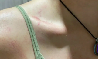 NTK Ruby Trần tố bạn trai cũ là HLV bơi bạo hành, quỵt tiền