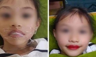 Xôn xao clip bé gái mới 5 tuổi đi xăm môi theo yêu cầu của mẹ