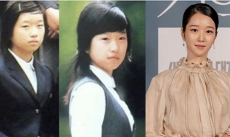 Giữa drama, 2 bác sĩ lên tiếng làm rõ nghi án Seo Ye Ji thẩm mỹ 