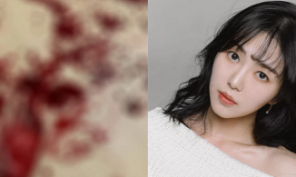 Nghi vấn Kwon Mina (cựu thành viên AOA) tự tử lần 3 khi đăng ảnh bàn tay đầy máu