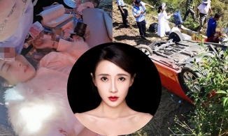 Diễn viên Lý Hy Nhi gặp tai nạn xe nghiêm trọng, nhập viện cấp cứu khâu 54 mũi