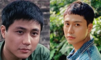 Ngoại hình Thanh Sơn 10 năm trước khác lạ ra sao mà bị nghi đến thăm bác sĩ