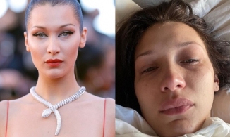 Nguyên nhân 'sốc' đằng sau việc Bella Hadid thường xuyên đăng ảnh khóc lóc lên mạng xã hội