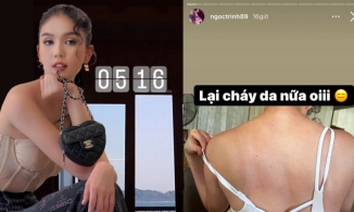 Đi resort 5 sao nhưng Ngọc Trinh dậy 5h sáng làm việc, cháy cả làn da thương hiệu