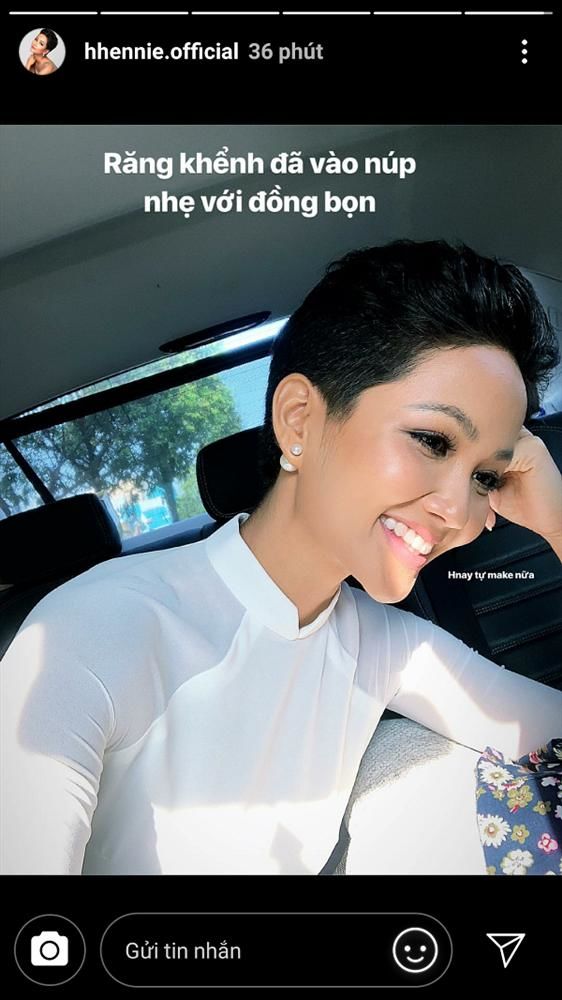  Hoa hậu Đỗ Thị Hà quyết định thẩm mỹ khuyết điểm này trên gương mặt - Ảnh 8