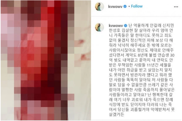 Nghi vấn Kwon Mina (cựu thành viên AOA) tự tử lần 3 khi đăng ảnh bàn tay đầy máu - Ảnh 5