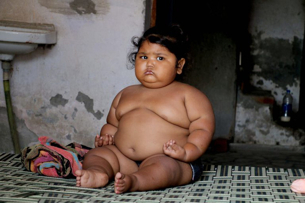 Bé gái nặng nhất thế giới 8 tháng tuổi 20kg từng gây sốt MXH giờ ra sao? - Ảnh 8