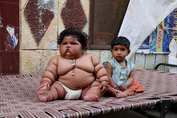Bé gái nặng nhất thế giới 8 tháng tuổi 20kg từng gây sốt MXH giờ ra sao? - Ảnh 2