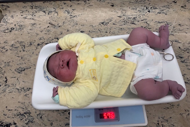 Hà Nội: Trẻ sơ sinh nặng gần 6kg khi chào đời - Ảnh 1