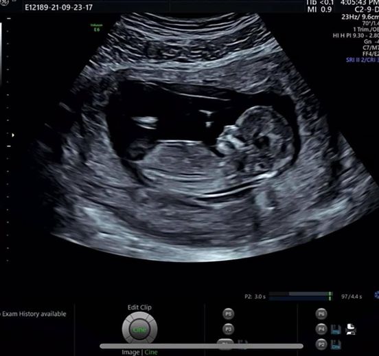 Salim công khai hình ảnh siêu âm con đầu lòng trong ngày đầu năm mới 2022.