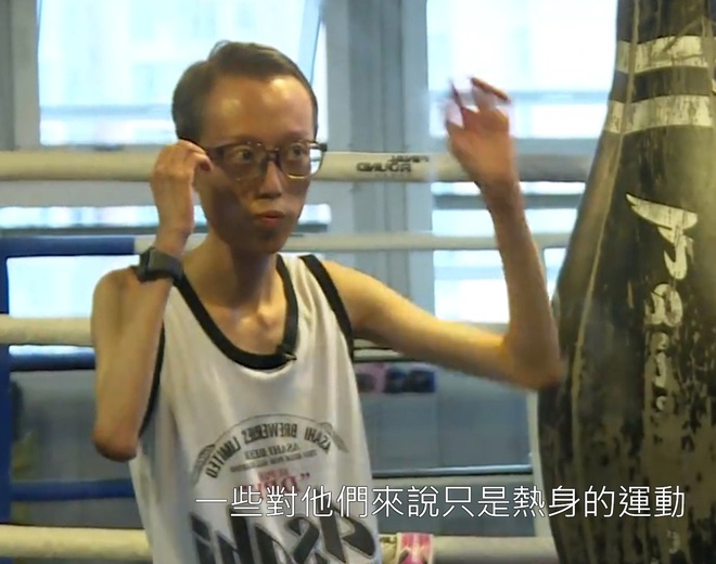 Nam diễn viên Hong Kong duy trì cân nặng 40 kg để chuyên vào vai người bệnh - Ảnh 2