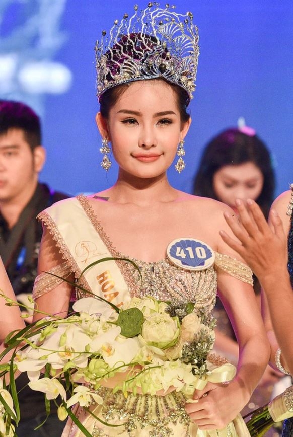 Lê Âu Ngân Anh là ai? - Ảnh 1