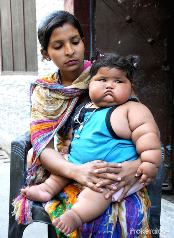 Bé gái nặng nhất thế giới 8 tháng tuổi 20kg từng gây sốt MXH giờ ra sao? - Ảnh 4