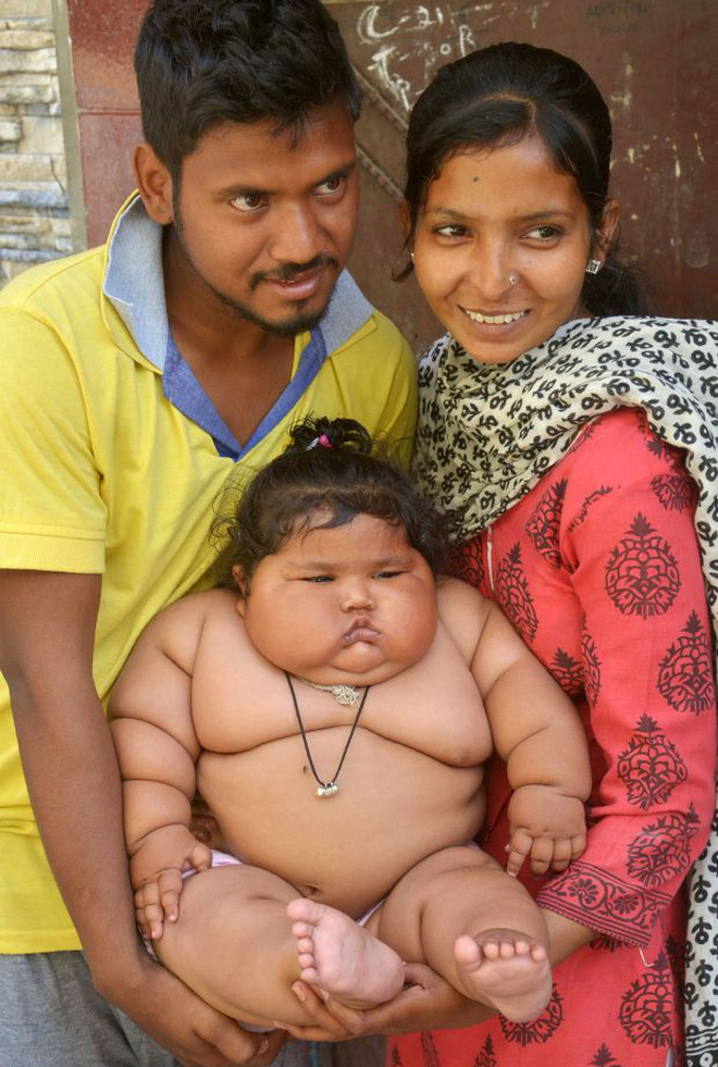 Bé gái nặng nhất thế giới 8 tháng tuổi 20kg từng gây sốt MXH giờ ra sao? - Ảnh 3