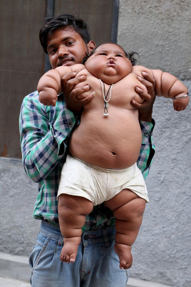 Bé gái nặng nhất thế giới 8 tháng tuổi 20kg từng gây sốt MXH giờ ra sao? - Ảnh 7