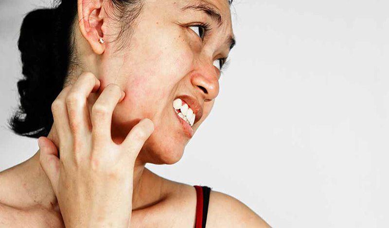 Nguyên nhân gây tình trạng da mặt bị ngứa có thể do bị dị ứng, khô da, hoặc do nhiều nguyên nhân khác,...