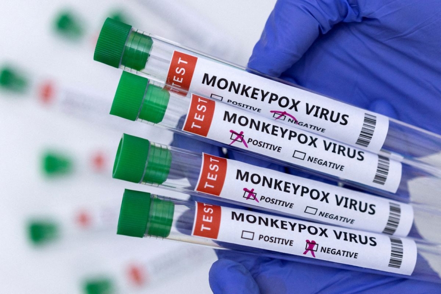 Singapore phát hiện ca bệnh đậu mùa khỉ đầu tiên trong 3 năm qua.