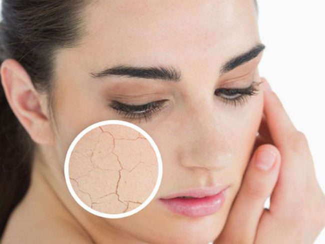 Nguyên nhân gây tình trạng da khô có thể do tác động từ bên trong hoặc từ các yếu tố bên ngoài.