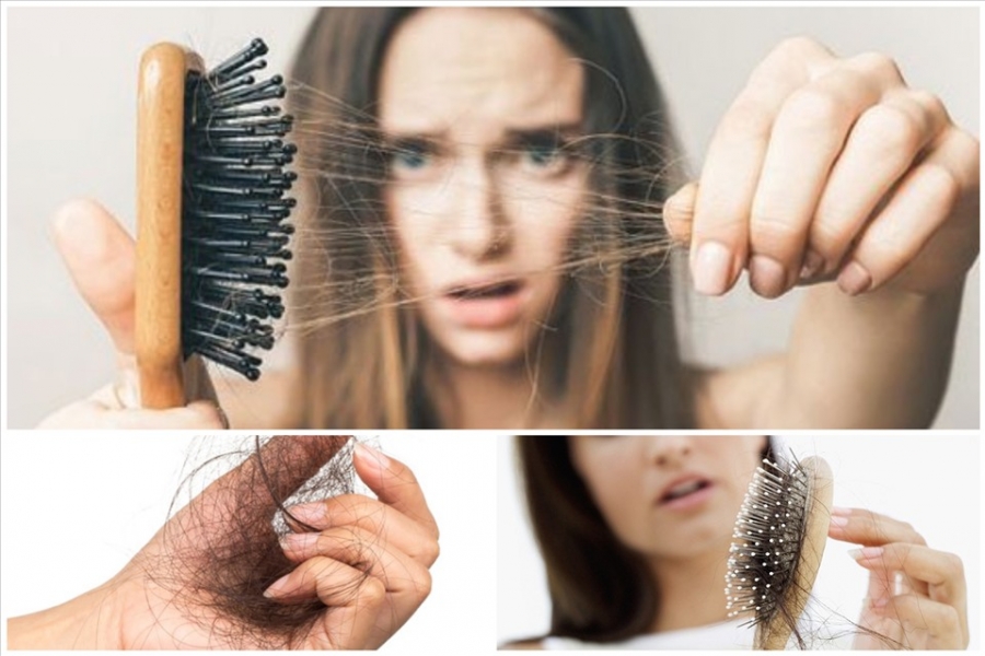 Biotin trị rụng tóc có tốt không và sự thật được tiết lộ - Ảnh 1