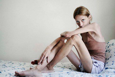 Năm 2010, người ta tiếp tục sợ hãi khi nghe tin người mẫu Isabelle Caro đột tử vì tự bỏ đói mình.