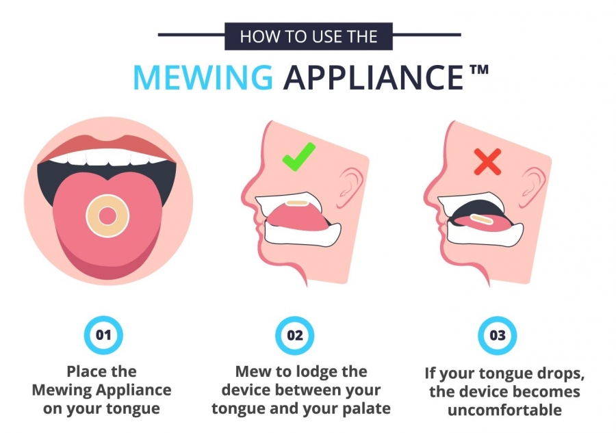 Phương pháp Mewing: Đặt lưỡi lên vòm họng cũng có thể cải thiện thẩm mỹ gương mặt.