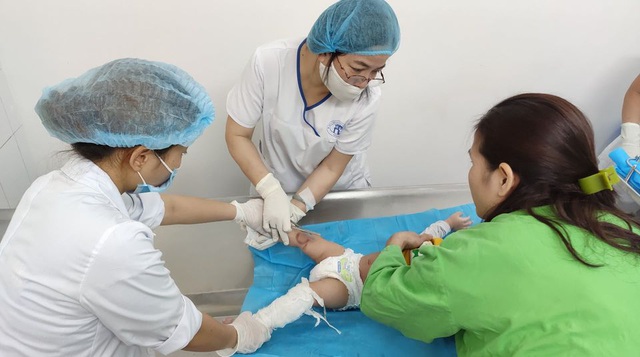 Bé 7 tháng tuổi phải nằm viện 4 tuần vì mẹ dùng kem đánh răng chữa bỏng