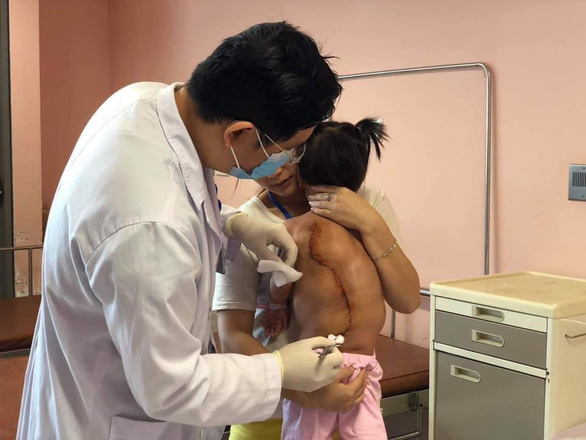 Bé gái 16kg mang trong người khối u 4kg - Ảnh: Bệnh viện cung cấp