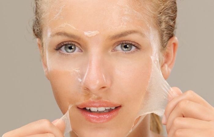 Quá trình peel da kích thích tế bào da bong tróc giúp tái tạo làn da mới, loại bỏ các nếp nhăn.