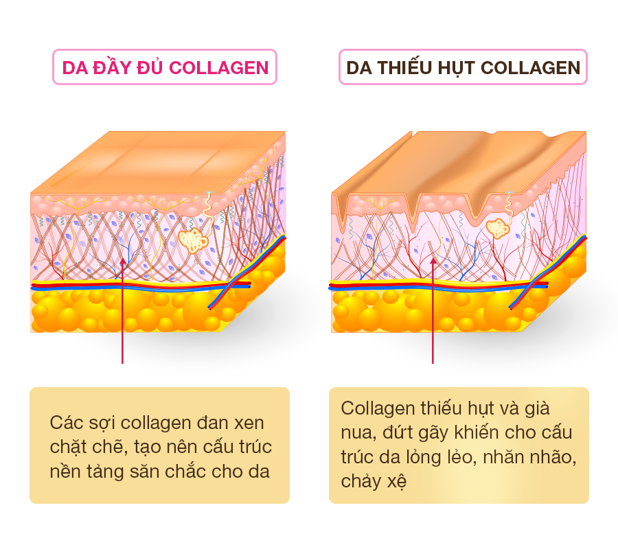 Việc lạm dụng kem tẩy lông có thể phá vỡ cấu trúc collagen làm giảm độ đàn hồi da.