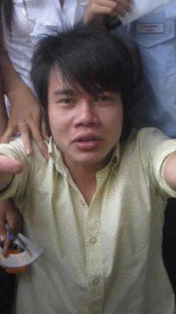 Nhìn lại hành trình lột xác của Lê Dương Bảo Lâm: Chấp nhận phẫu thuật 10 ngày/lần - Ảnh 7