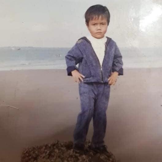 Nhìn lại hành trình lột xác của Lê Dương Bảo Lâm: Chấp nhận phẫu thuật 10 ngày/lần - Ảnh 9