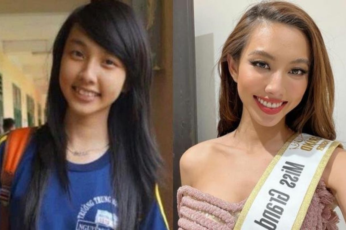 Loạt Hoa hậu, Á hậu "lên hương" nhan sắc chỉ nhờ tân trang răng lợi