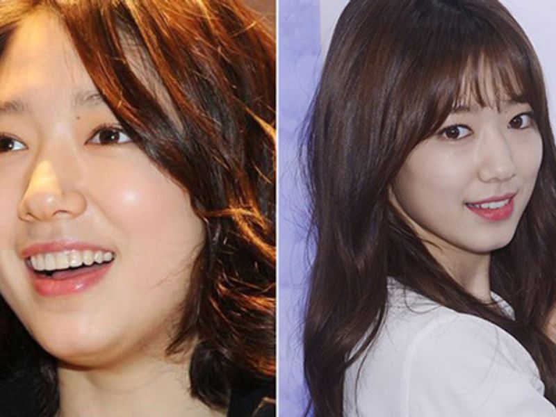 Giảm béo mặt bằng đá viên như Park Shin Hye: Mặt V-line trong tầm tay