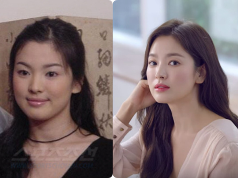 Hội sao Hàn đổi đời nhờ giảm cân: Song Hye Kyo thăng hạng nhan sắc, bất ngờ nhất là diễn viên từng n - Ảnh 1