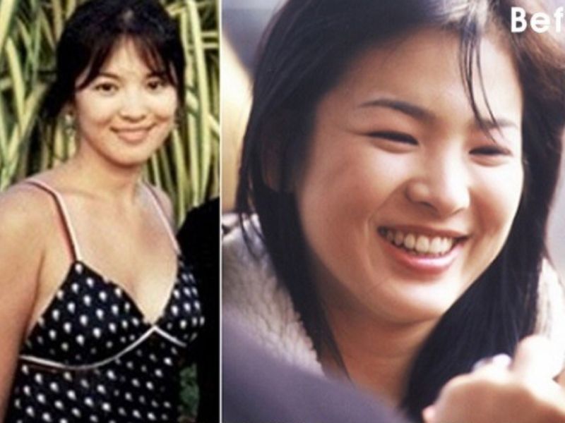 Sao Hàn đổi đời nhờ giảm cân: Song Hye Kyo thăng hạng nhan sắc, bất ngờ nhất là diễn viên nặng 120kg