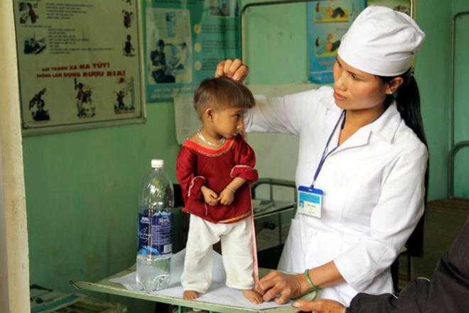 Hội chứng "người lùn đầu chim" mà cậu bé K'Rể mắc phải và cách phòng tránh