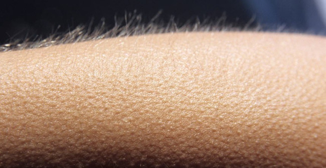 Tại sao chúng ta lại "nổi da gà"?