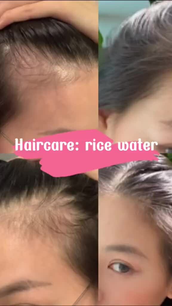 Thành quả sau một tuần gội đầu với nước gạo lên men, không những tóc chắc khỏe hơn mà còn mọc nhiều hơn trước.