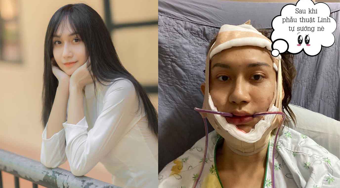 Hơn 1 tỷ đồng là số tiền Lynk Lee đã chi để trở thành mỹ nhân như hiện tại