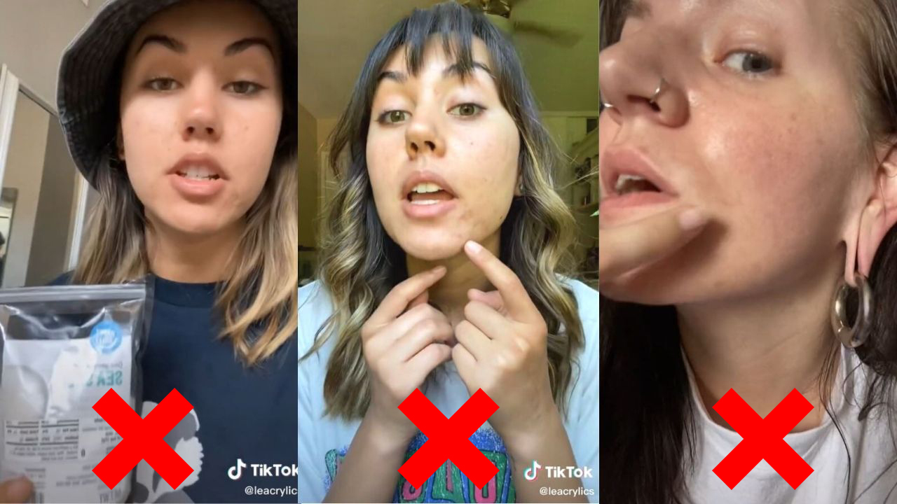 Chuyên gia khuyên bạn không nên thử trị mụn theo 5 cách này trên TikTok