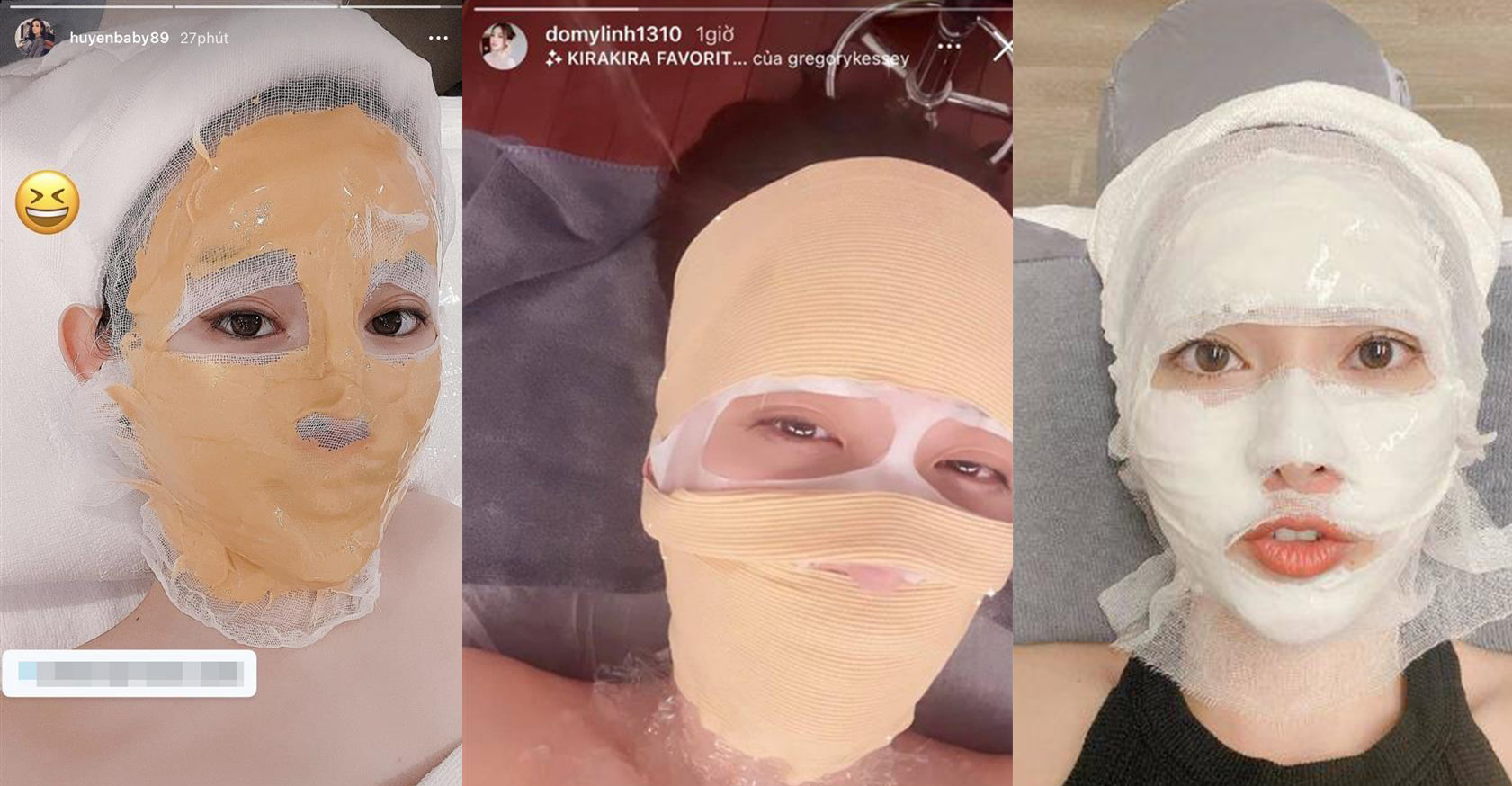 Huyền Baby, Đỗ Mỹ Linh băng bó kín mặt như xác ướp Ai Cập: Điều gì đang xảy ra?
