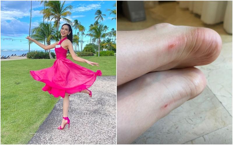 Đỗ Thị Hà mang giày cao gót phồng rộp cả chân là do cô chưa biết đến những mẹo này