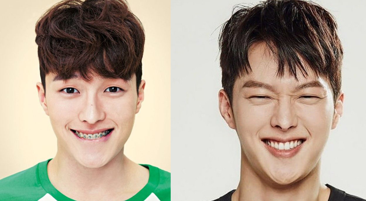 Tình trẻ của Song Hye Kyo - Jang Ki Yong và dàn mỹ nam Hàn "lột xác" ngoạn mục nhờ niềng răng