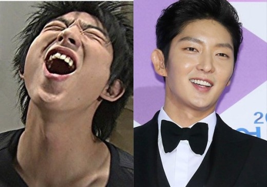 Nam diễn viên Lee Jun Ki có một chiếc răng cửa vênh lên và anh chàng đã xử lý bằng hình thức niềng răng.