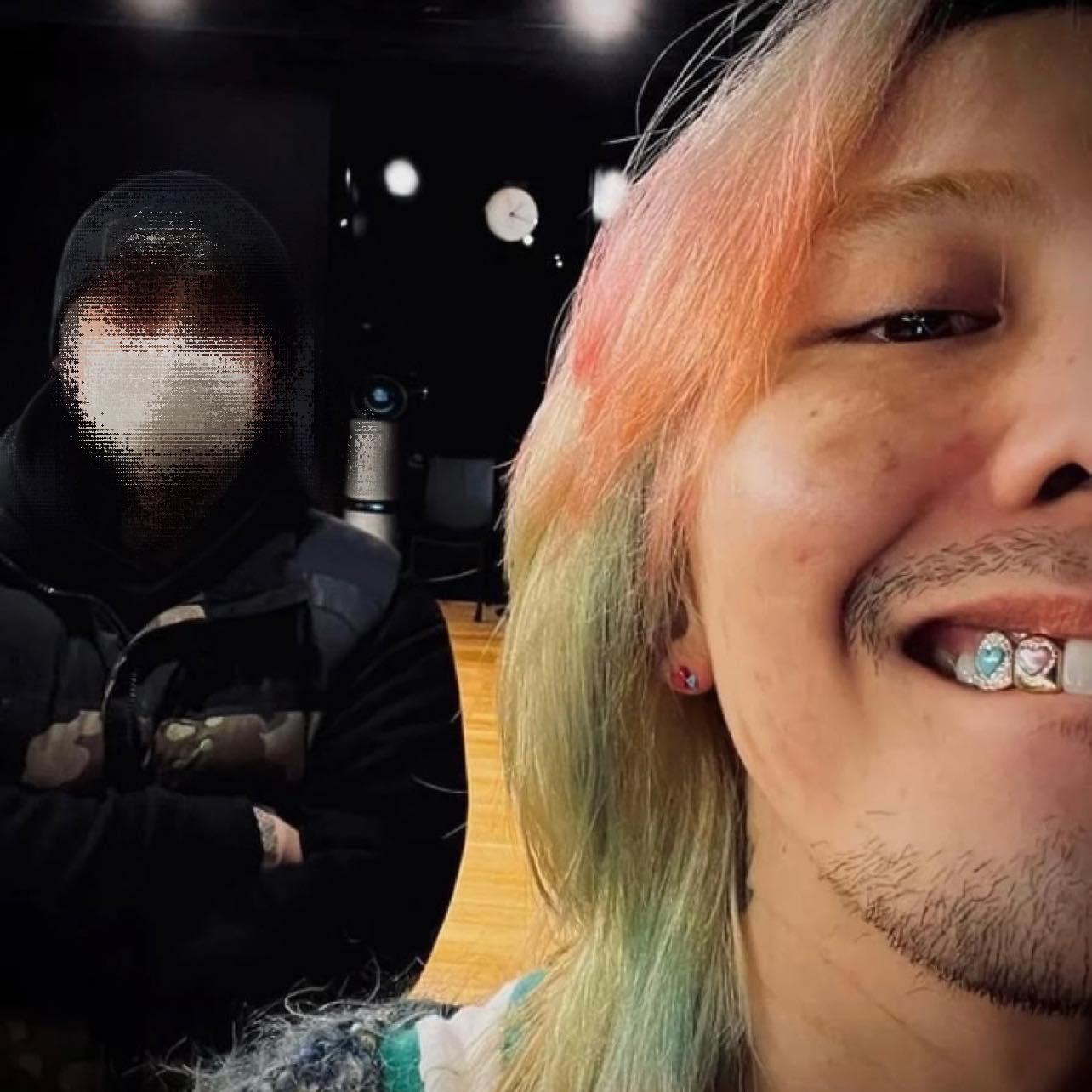 G-Dragon khoe 2 chiếc răng kim cương 'mới tậu' trong một bức ảnh selfie ở hậu trường.
