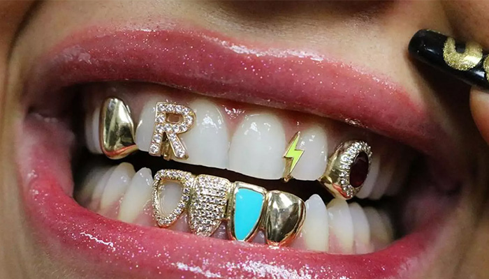 Nụ cười với "một mồm" trang sức: Xu hướng mới được các Hiphop-er ưa chuộng