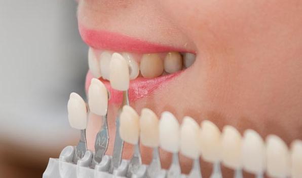Tuổi thọ trung bình của mão răng sứ là từ 5-15 năm, phụ thuộc vào chất lượng mão răng và quá trình chăm sóc răng miệng của bạn.